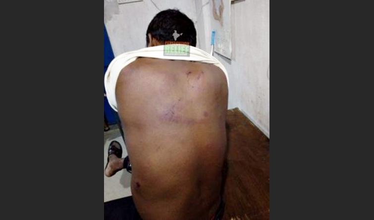 Com marcas da violência pelo corpo, pastor é espancado em culto por radicais hindus na Índia por pregar a Bíblia Sagrada