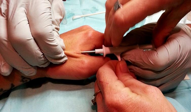 Teólogo faz alerta sobre microchips! Pode ser a preparação para a “marca da besta”